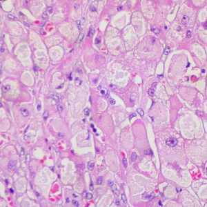 Liver hepatocytes